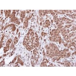 Immunohistochemistry - alpha Actinin 4 antibody from Signalway Antibody (22593) - Antibodies.com