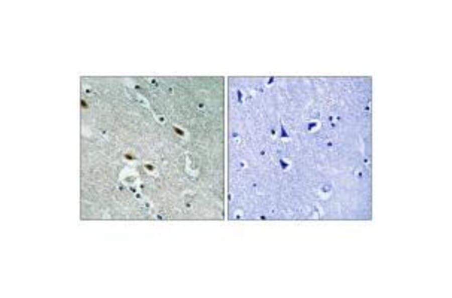 Immunohistochemistry - c-Met (Ab-1003) Antibody from Signalway Antibody (33155) - Antibodies.com