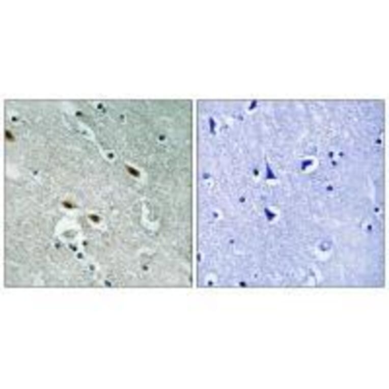 Immunohistochemistry - c-Met (Ab-1003) Antibody from Signalway Antibody (33155) - Antibodies.com