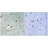 Immunohistochemistry - c-Met (Ab-1003) Antibody from Signalway Antibody (33155) - Antibodies.com