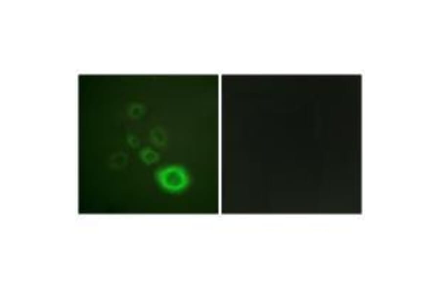 Immunofluorescence - c-Met (Ab-1003) Antibody from Signalway Antibody (33155) - Antibodies.com