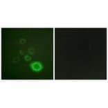 Immunofluorescence - c-Met (Ab-1003) Antibody from Signalway Antibody (33155) - Antibodies.com