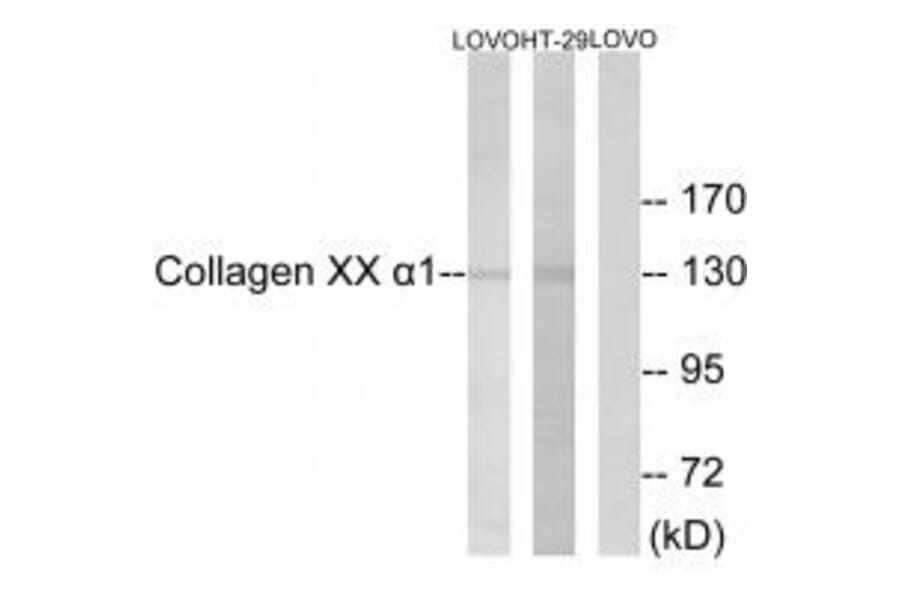 Western blot - Collagen XX α1 Antibody from Signalway Antibody (34218) - Antibodies.com
