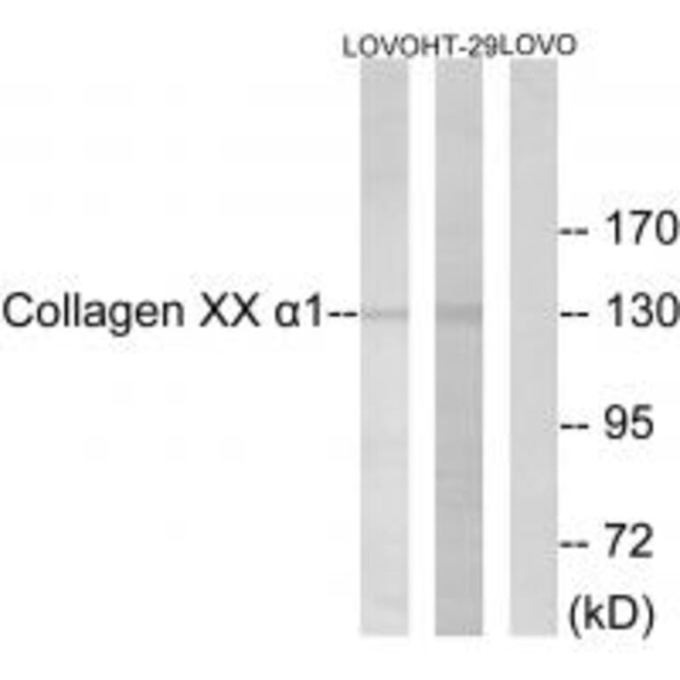 Western blot - Collagen XX α1 Antibody from Signalway Antibody (34218) - Antibodies.com