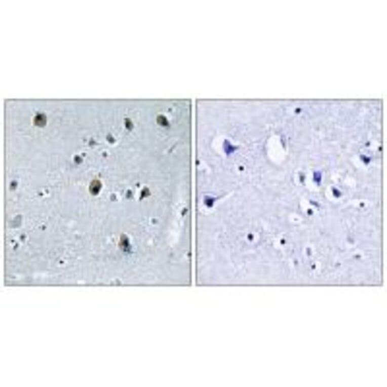 Immunohistochemistry - Collagen XX α1 Antibody from Signalway Antibody (34218) - Antibodies.com