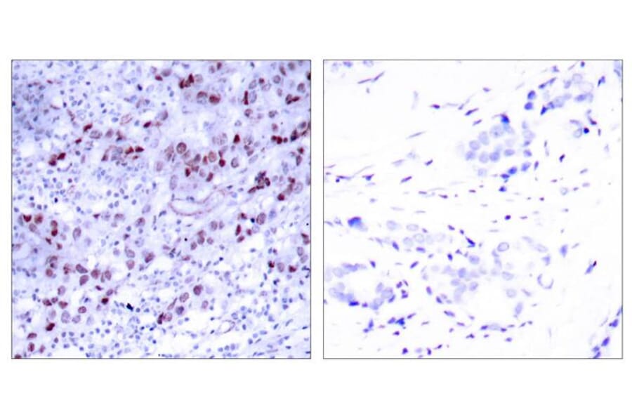 Immunohistochemistry - GATA1 (Ab-142) Antibody from Signalway Antibody (21041) - Antibodies.com