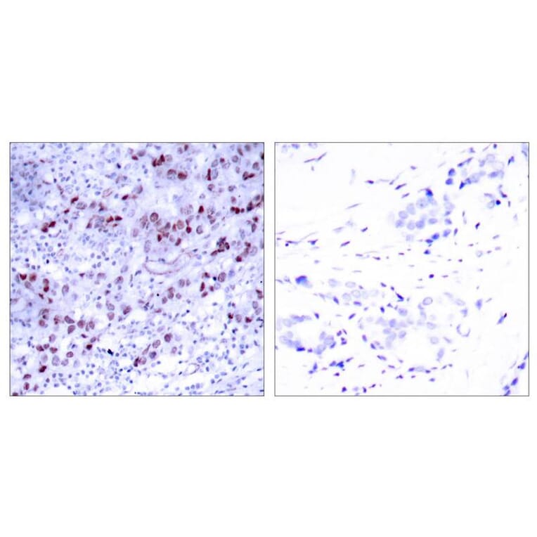 Immunohistochemistry - GATA1 (Ab-142) Antibody from Signalway Antibody (21041) - Antibodies.com