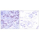 Immunohistochemistry - GATA1 (Ab-142) Antibody from Signalway Antibody (21041) - Antibodies.com