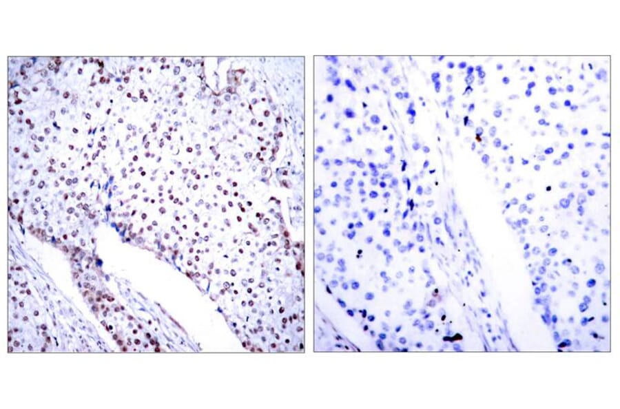 Immunohistochemistry - STAT3 (Ab-705) Antibody from Signalway Antibody (21045) - Antibodies.com