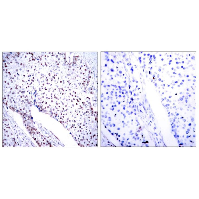 Immunohistochemistry - STAT3 (Ab-705) Antibody from Signalway Antibody (21045) - Antibodies.com