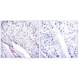 Immunohistochemistry - STAT3 (Ab-705) Antibody from Signalway Antibody (21045) - Antibodies.com