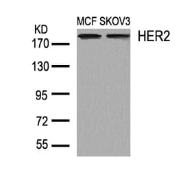 Western blot - HER2 (Ab-1248) Antibody from Signalway Antibody (21072) - Antibodies.com