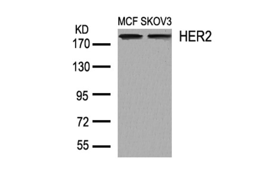 Western blot - HER2 (Ab-1248) Antibody from Signalway Antibody (21072) - Antibodies.com