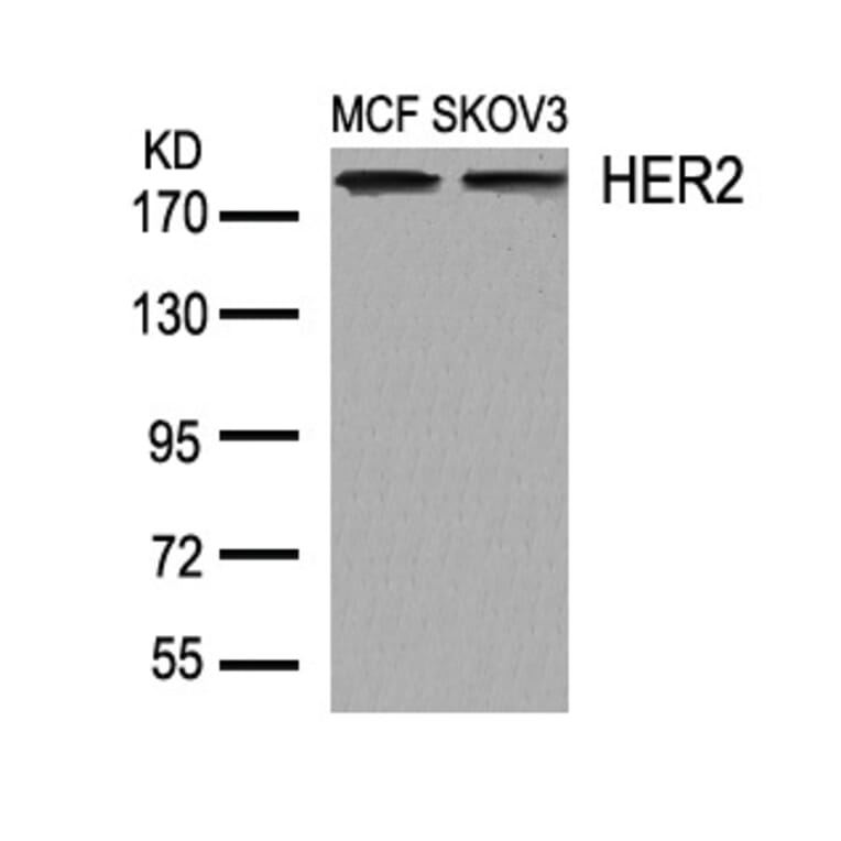 Western blot - HER2 (Ab-1248) Antibody from Signalway Antibody (21072) - Antibodies.com