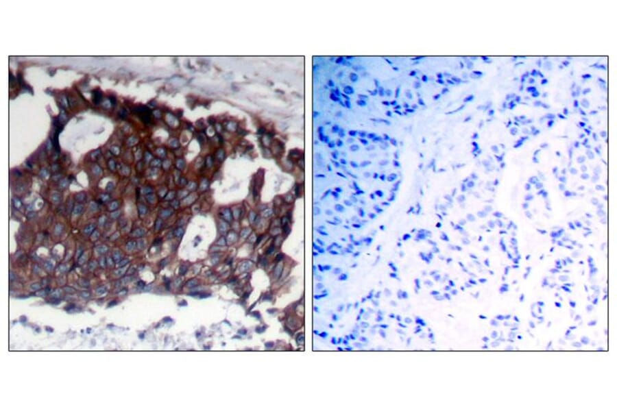 Immunohistochemistry - HER2 (Ab-1248) Antibody from Signalway Antibody (21072) - Antibodies.com