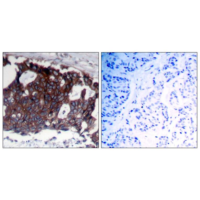 Immunohistochemistry - HER2 (Ab-1248) Antibody from Signalway Antibody (21072) - Antibodies.com
