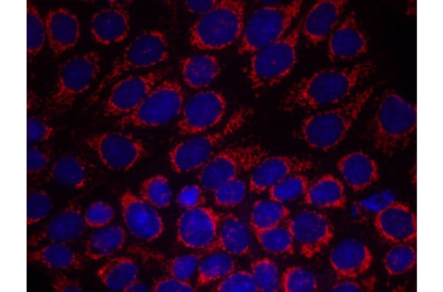 Immunofluorescence - HER2 (Ab-1248) Antibody from Signalway Antibody (21072) - Antibodies.com