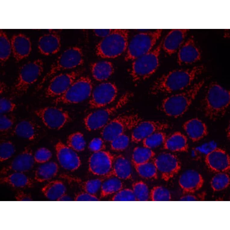 Immunofluorescence - HER2 (Ab-1248) Antibody from Signalway Antibody (21072) - Antibodies.com