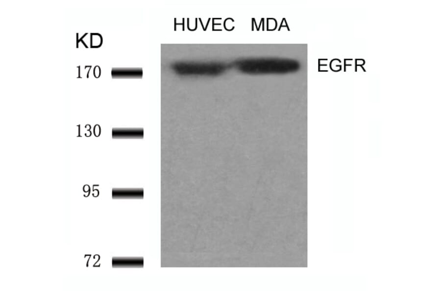 Western blot - EGFR (Ab-1070) Antibody from Signalway Antibody (21073) - Antibodies.com