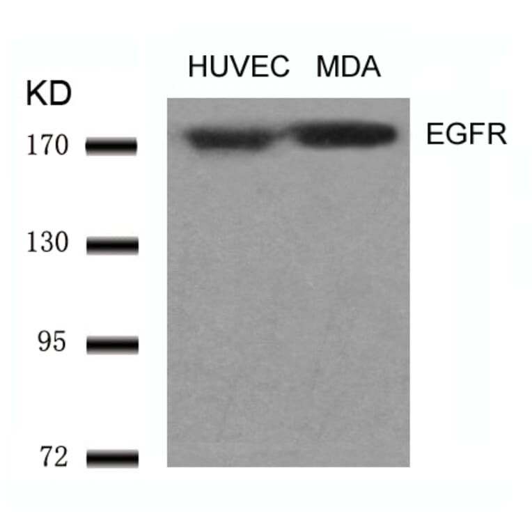 Western blot - EGFR (Ab-1070) Antibody from Signalway Antibody (21073) - Antibodies.com