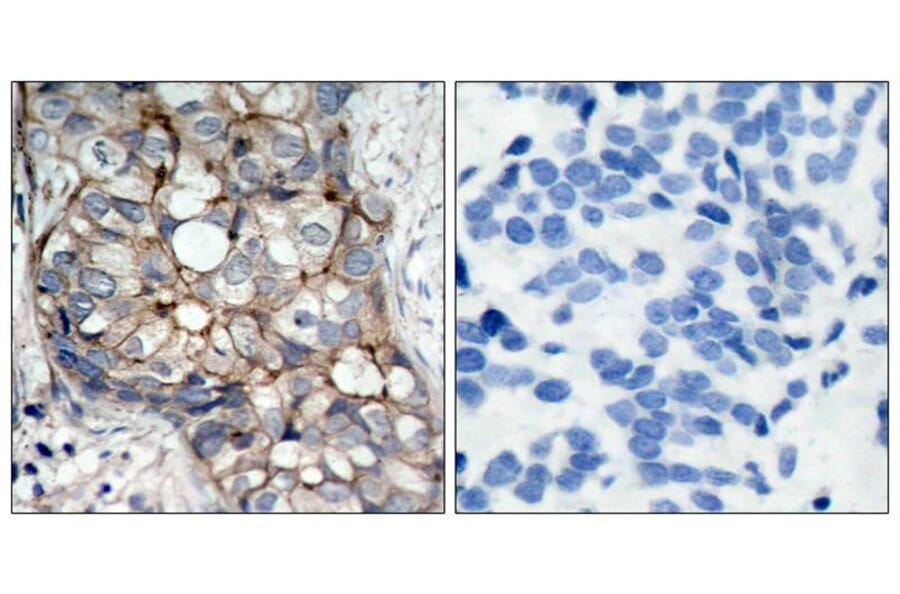Immunohistochemistry - EGFR (Ab-1070) Antibody from Signalway Antibody (21073) - Antibodies.com