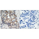 Immunohistochemistry - EGFR (Ab-1070) Antibody from Signalway Antibody (21073) - Antibodies.com