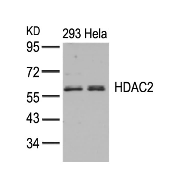 Western blot - HDAC2 (Ab-394) Antibody from Signalway Antibody (21140) - Antibodies.com