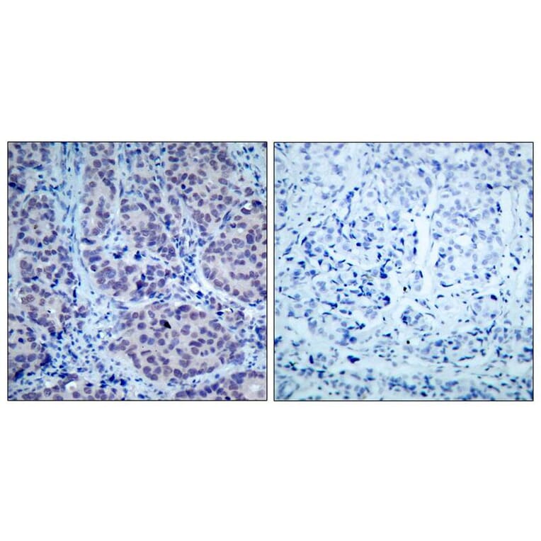 Immunohistochemistry - HDAC2 (Ab-394) Antibody from Signalway Antibody (21140) - Antibodies.com