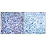 Immunohistochemistry - HDAC2 (Ab-394) Antibody from Signalway Antibody (21140) - Antibodies.com