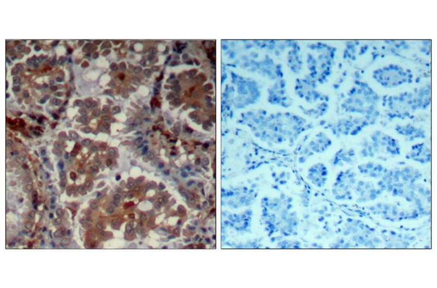 Immunohistochemistry - mTOR (Ab-2448) Antibody from Signalway Antibody (21214) - Antibodies.com