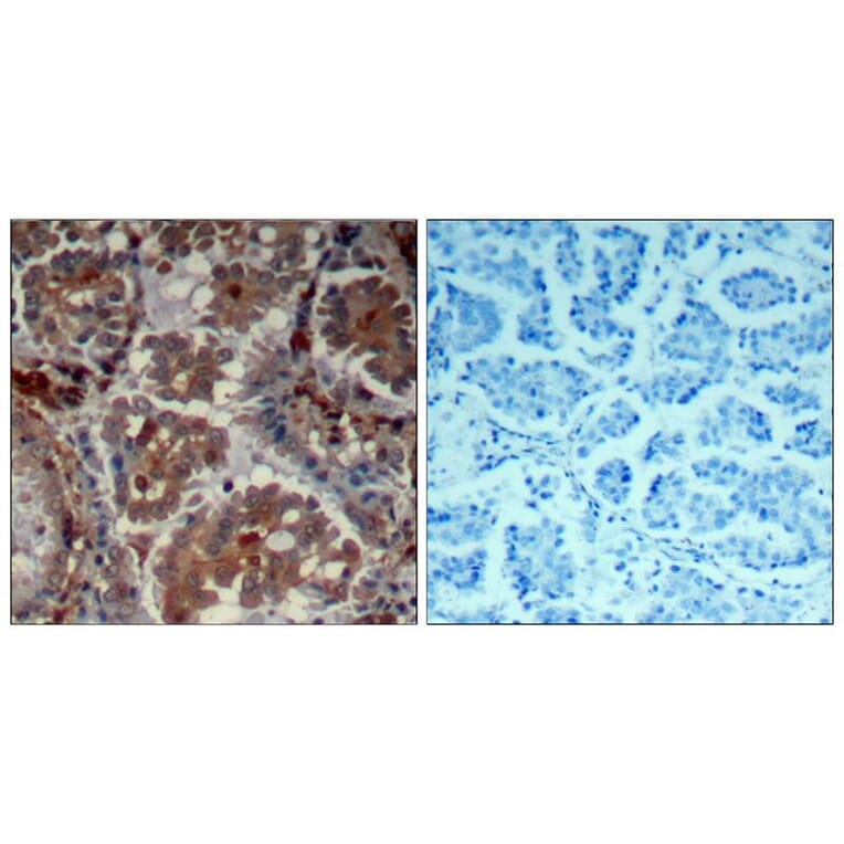Immunohistochemistry - mTOR (Ab-2448) Antibody from Signalway Antibody (21214) - Antibodies.com