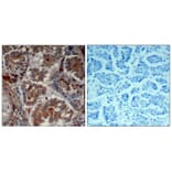 Immunohistochemistry - mTOR (Ab-2448) Antibody from Signalway Antibody (21214) - Antibodies.com