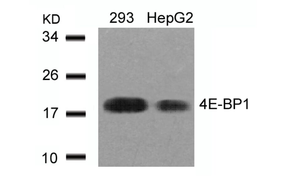 Western blot - 4E-BP1 (Ab-45) Antibody from Signalway Antibody (21216) - Antibodies.com