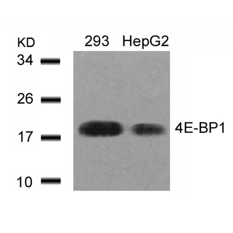 Western blot - 4E-BP1 (Ab-45) Antibody from Signalway Antibody (21216) - Antibodies.com