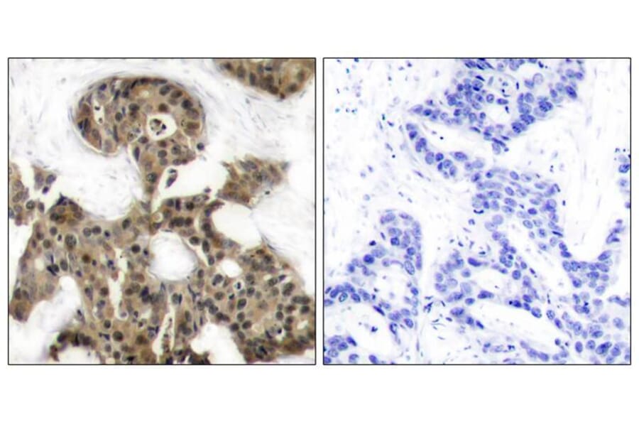 Immunohistochemistry - 4E-BP1 (Ab-45) Antibody from Signalway Antibody (21216) - Antibodies.com