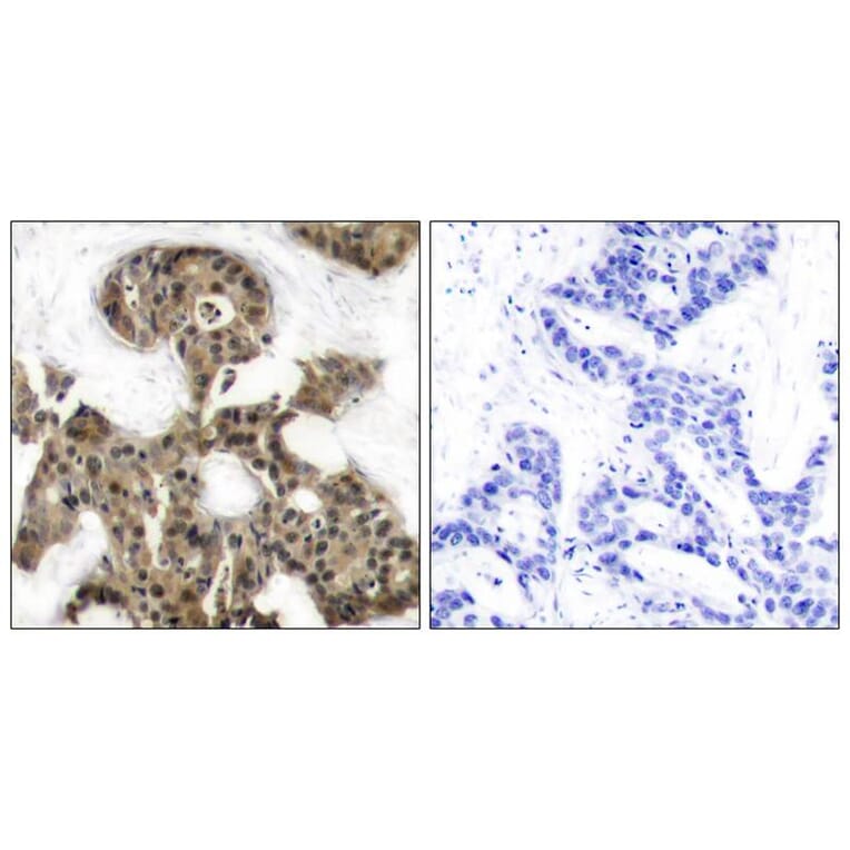 Immunohistochemistry - 4E-BP1 (Ab-45) Antibody from Signalway Antibody (21216) - Antibodies.com