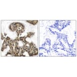 Immunohistochemistry - 4E-BP1 (Ab-45) Antibody from Signalway Antibody (21216) - Antibodies.com