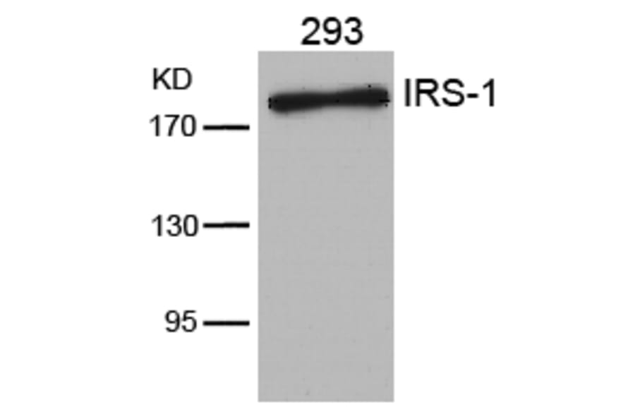 Western blot - IRS-1 (Ab-636) Antibody from Signalway Antibody (21223) - Antibodies.com
