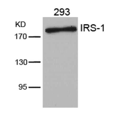 Western blot - IRS-1 (Ab-636) Antibody from Signalway Antibody (21223) - Antibodies.com