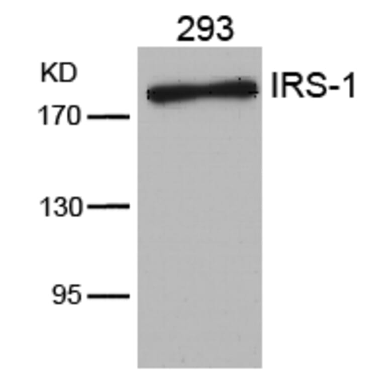 Western blot - IRS-1 (Ab-636) Antibody from Signalway Antibody (21223) - Antibodies.com