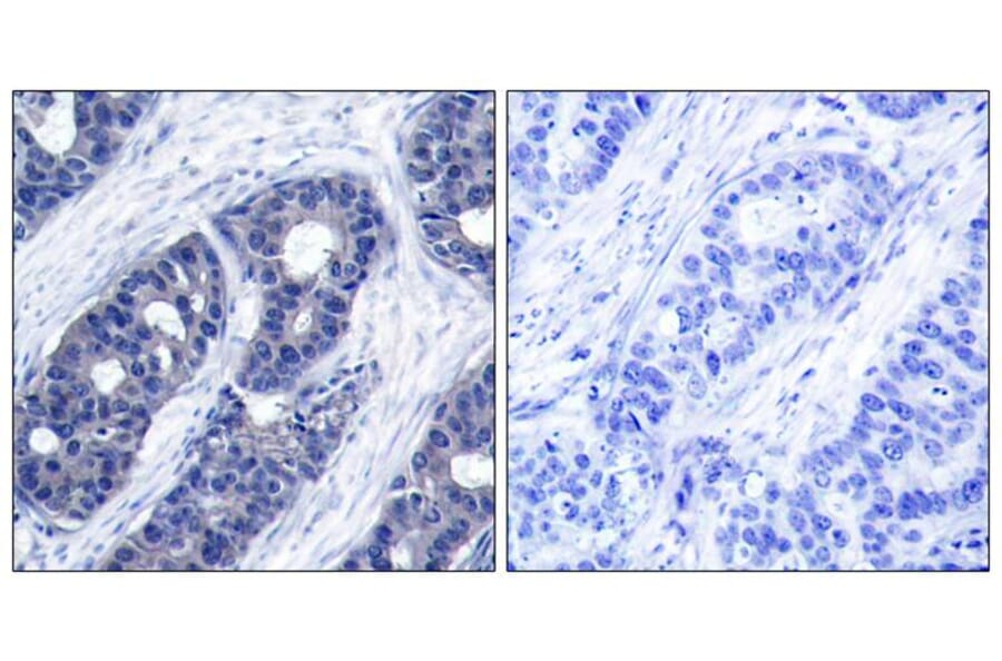 Immunohistochemistry - IRS-1 (Ab-636) Antibody from Signalway Antibody (21223) - Antibodies.com