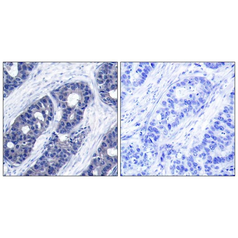 Immunohistochemistry - IRS-1 (Ab-636) Antibody from Signalway Antibody (21223) - Antibodies.com