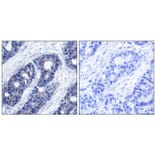 Immunohistochemistry - IRS-1 (Ab-636) Antibody from Signalway Antibody (21223) - Antibodies.com