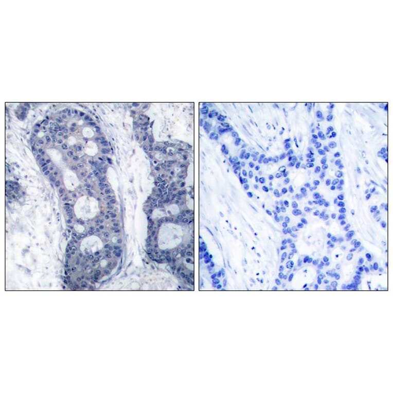 Immunohistochemistry - eIF4E (Ab-209) Antibody from Signalway Antibody (21226) - Antibodies.com