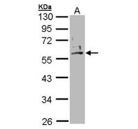 Cytokeratin 2e antibody from Signalway Antibody (22106) - Antibodies.com