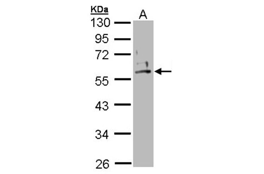 Cytokeratin 2e antibody from Signalway Antibody (22106) - Antibodies.com
