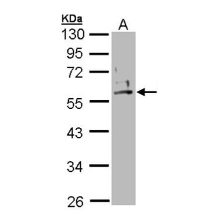 Cytokeratin 2e antibody from Signalway Antibody (22106) - Antibodies.com