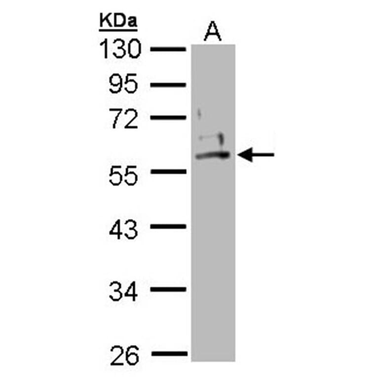 Cytokeratin 2e antibody from Signalway Antibody (22106) - Antibodies.com