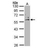 Cytokeratin 2e antibody from Signalway Antibody (22106) - Antibodies.com