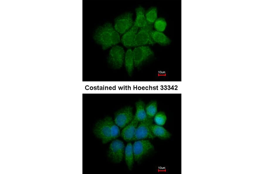Immunofluorescence - Cytokeratin 2e antibody from Signalway Antibody (22106) - Antibodies.com
